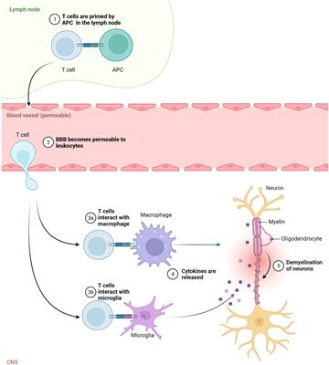 Frontiers | Autoreactive Lymphocytes In Multiple Sclerosis ...